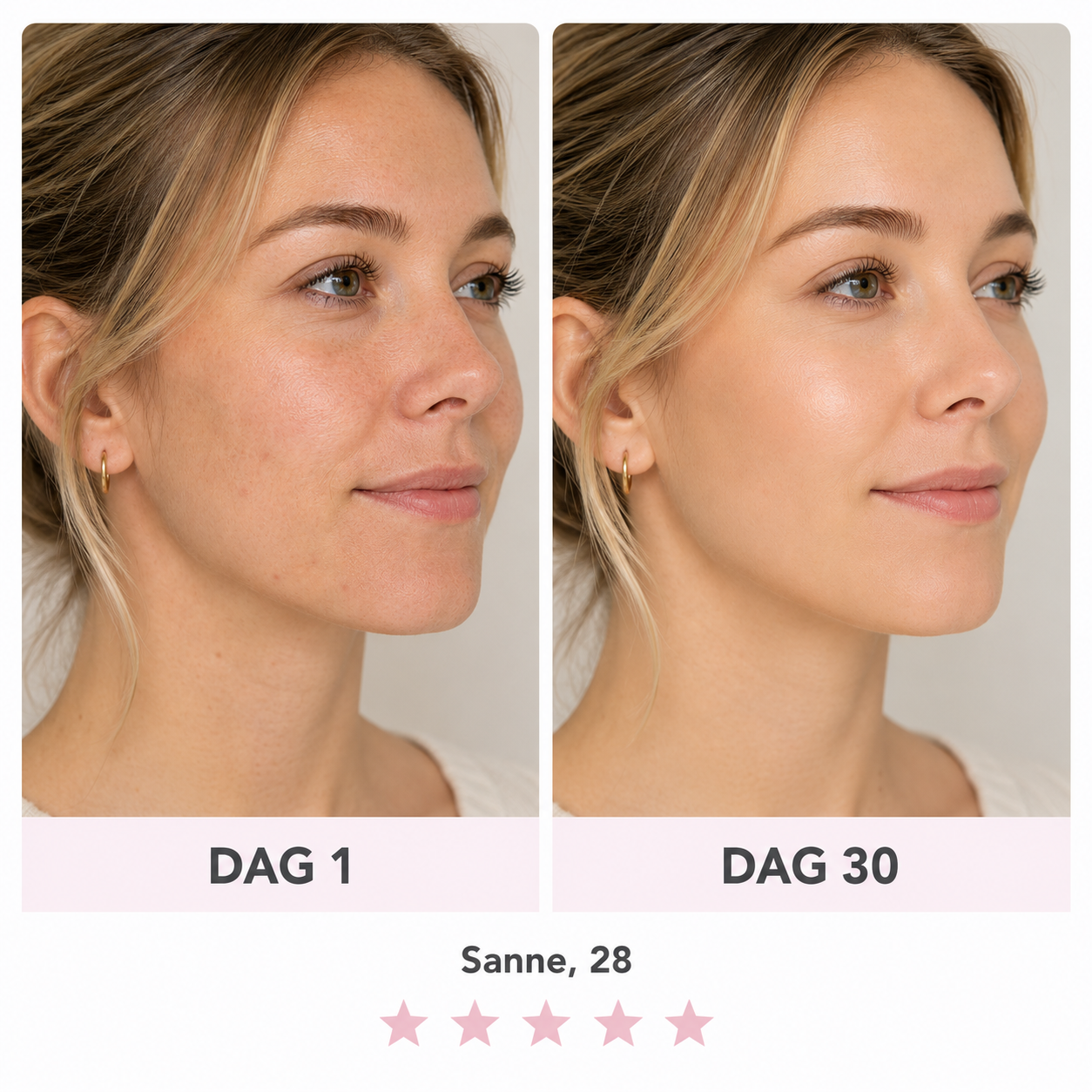 LumaLift | Je dagelijkse 5-minuten facelift