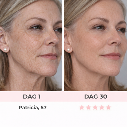 LumaLift | Je dagelijkse 5-minuten facelift