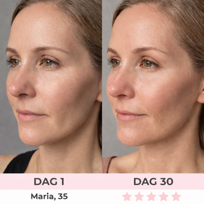 LumaLift | Je dagelijkse 5-minuten facelift